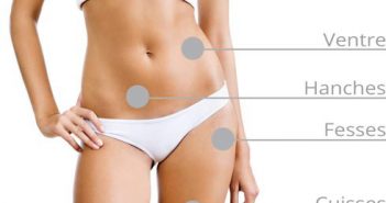 amincissement par Cryofit à Verdun en Meuse